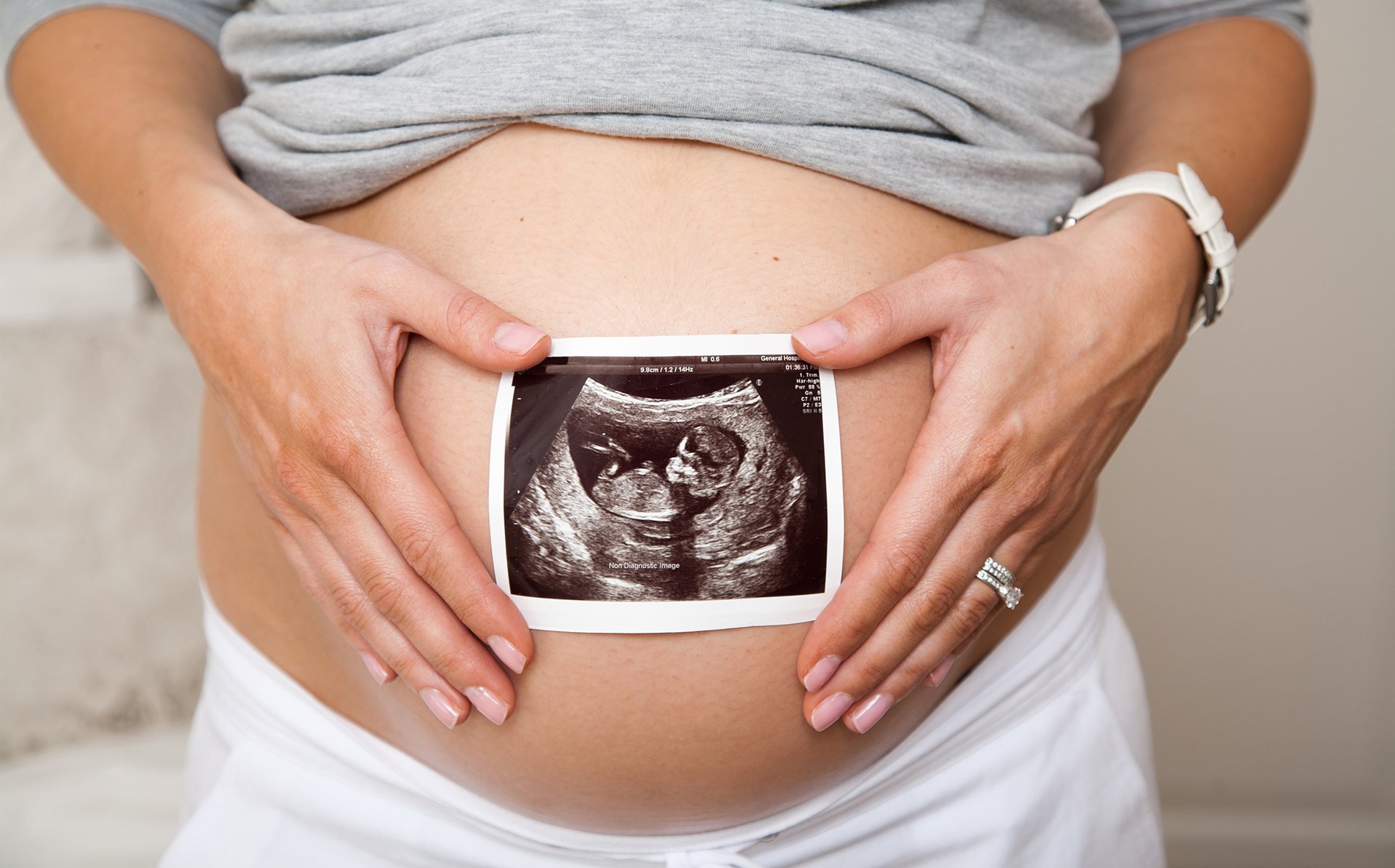 Mama trzyma zdjecie USG na ciazowym brzuchu